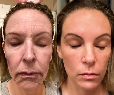 Crema Juventud Instantánea - Elimina arrugas en 5 minutos