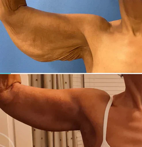 Crema Juventud Instantánea - Elimina arrugas en 5 minutos